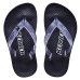 Chinelo Infantil Kenner New Summer Kids - Preto e Branco